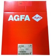 Рентгеновская термоплёнка для общей рентгенологии Agfa Drystar DT 2 B 35x43 см